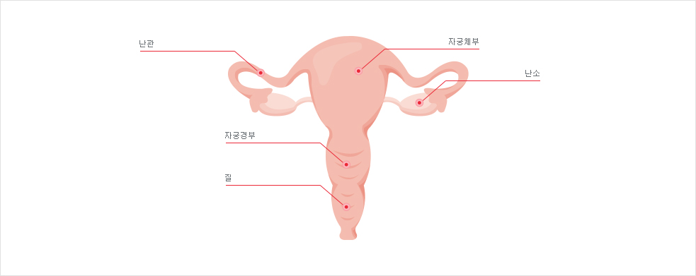 자궁의 구조 사진 : 난관, 자궁체부, 자궁경부, 난소, 질의 위치 설명 